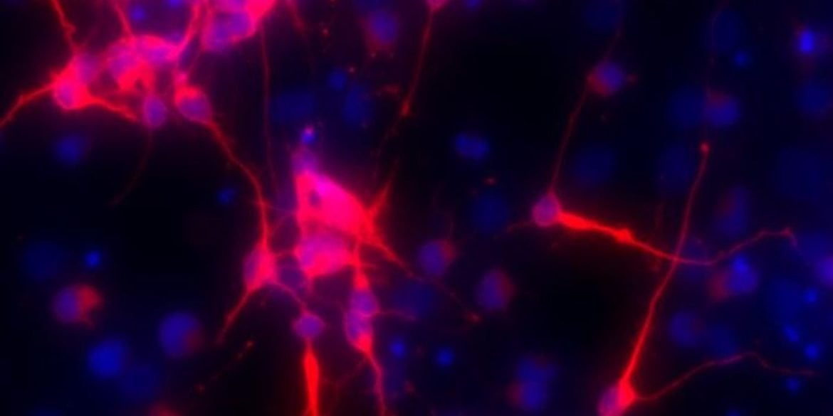 This shows hippocampal neurons.