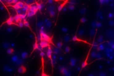 This shows hippocampal neurons.