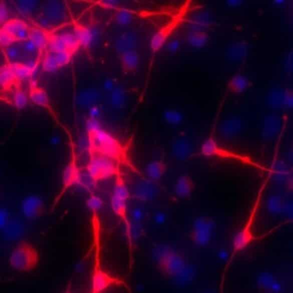 This shows hippocampal neurons.