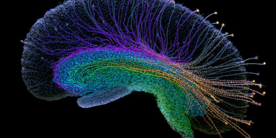 This shows the hippocampus.