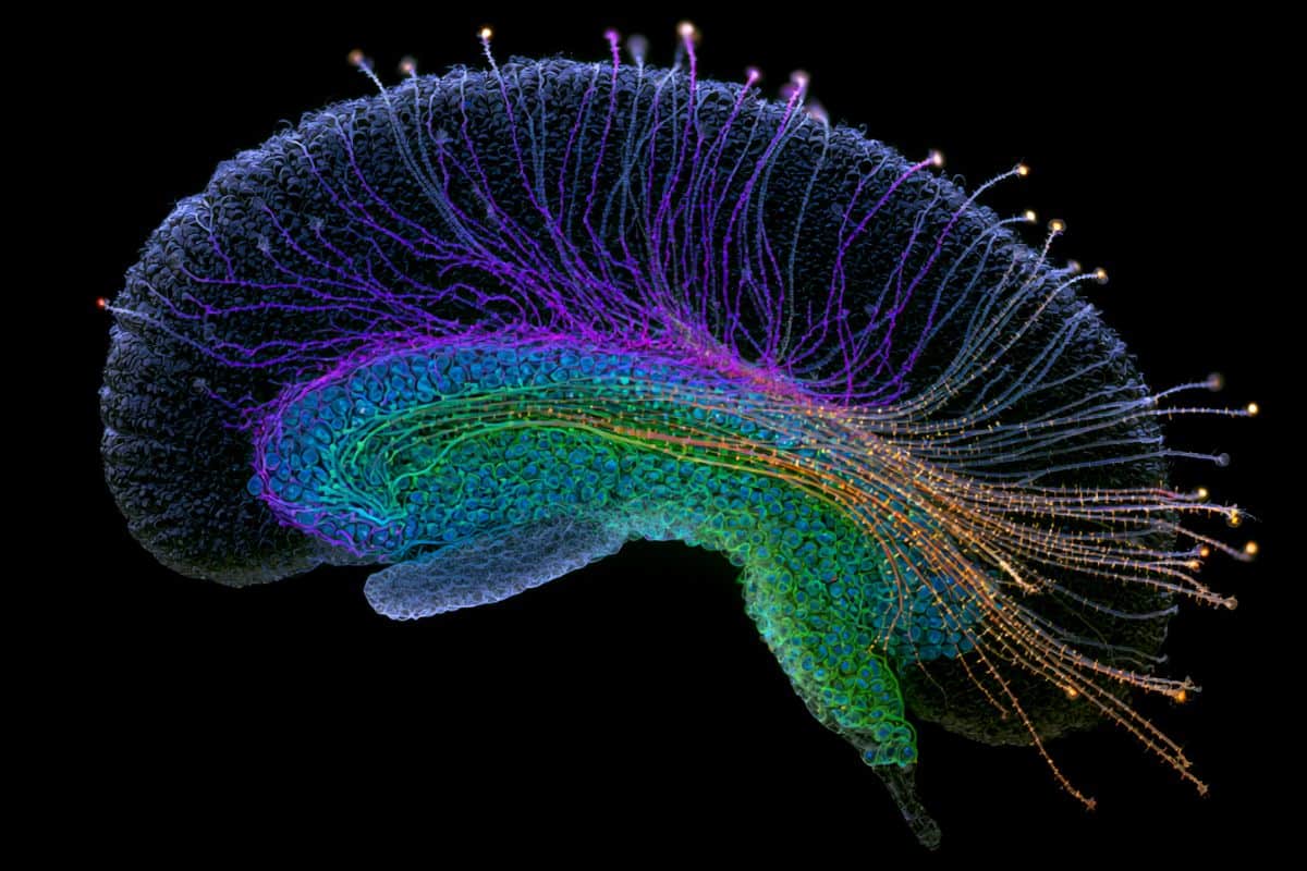 This shows the hippocampus.