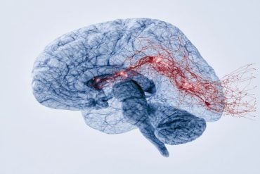 This shows a brain.