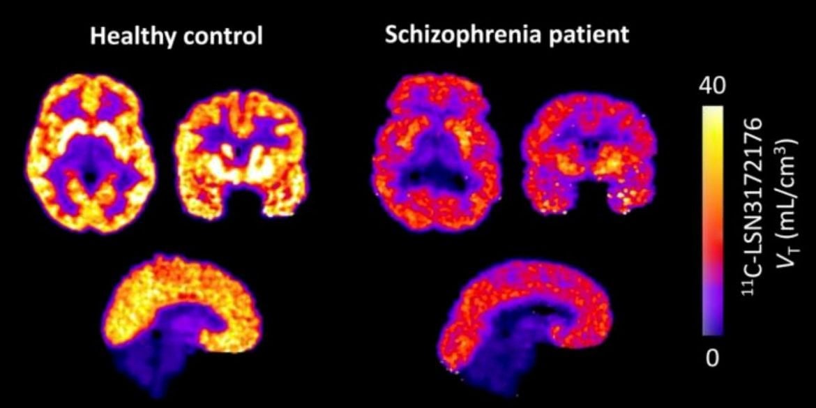 This shows brain scans from the study.