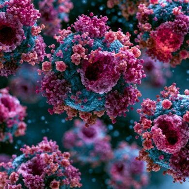 This shows macrophages.