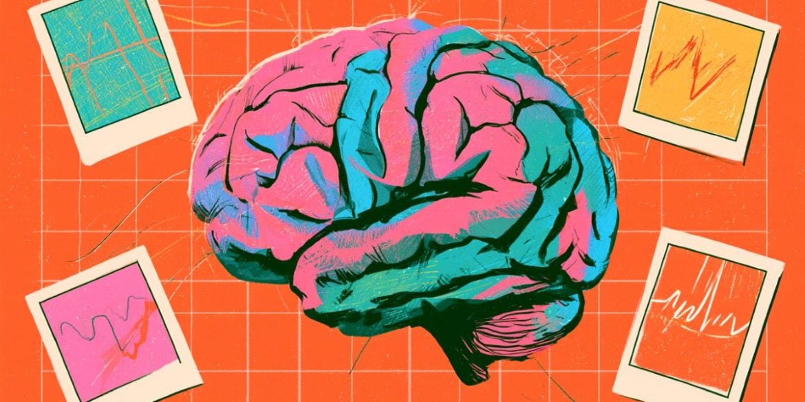This shows a brain.