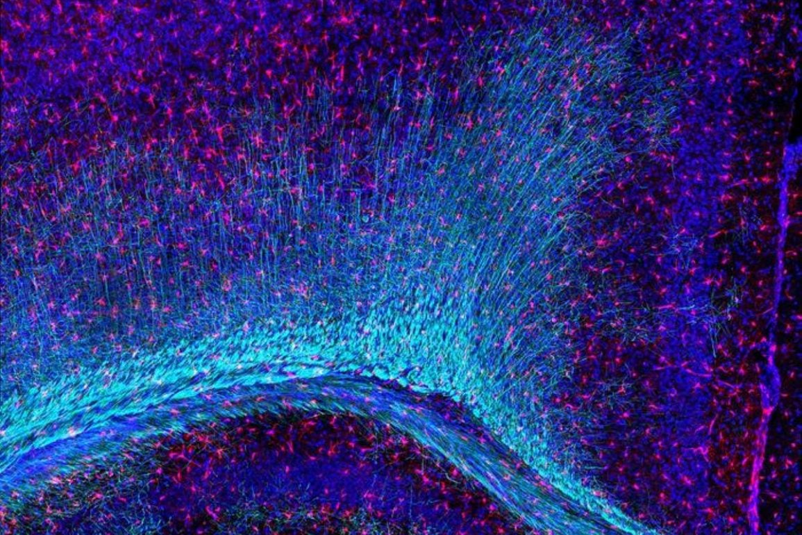 Loss of TDP-43 Strips Microglia of Their Brain-Cleaning Power