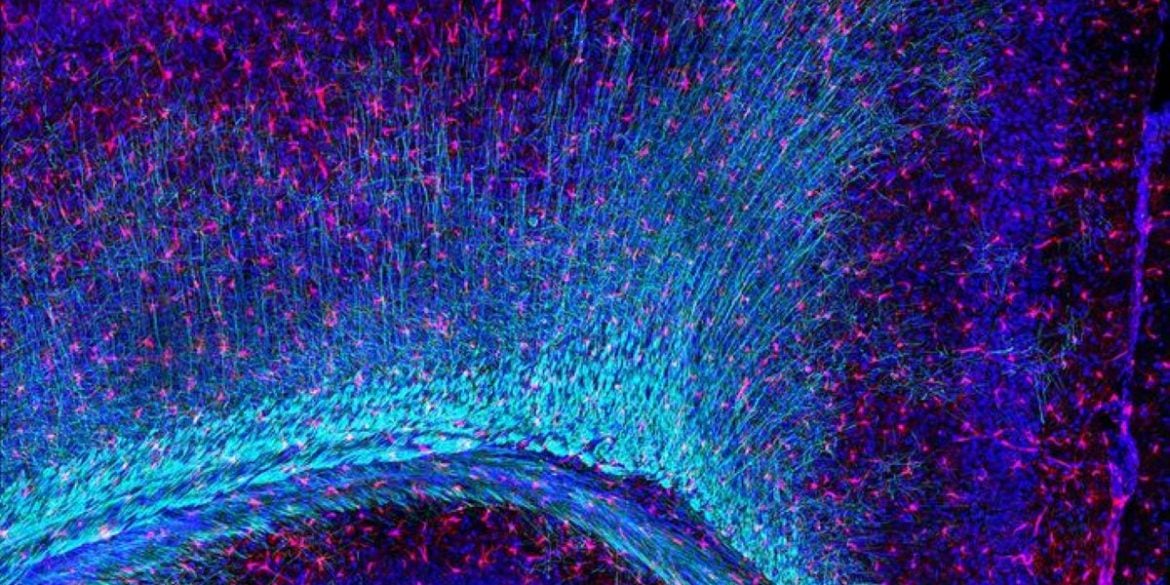 This shows myelin and microglia.