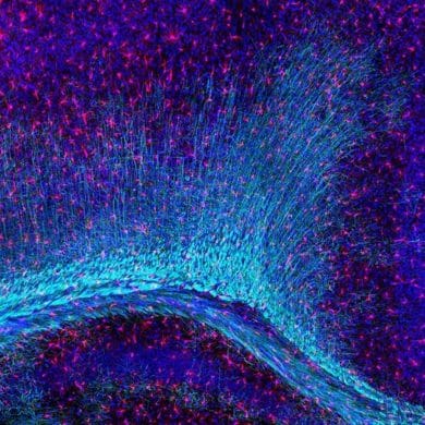 This shows myelin and microglia.