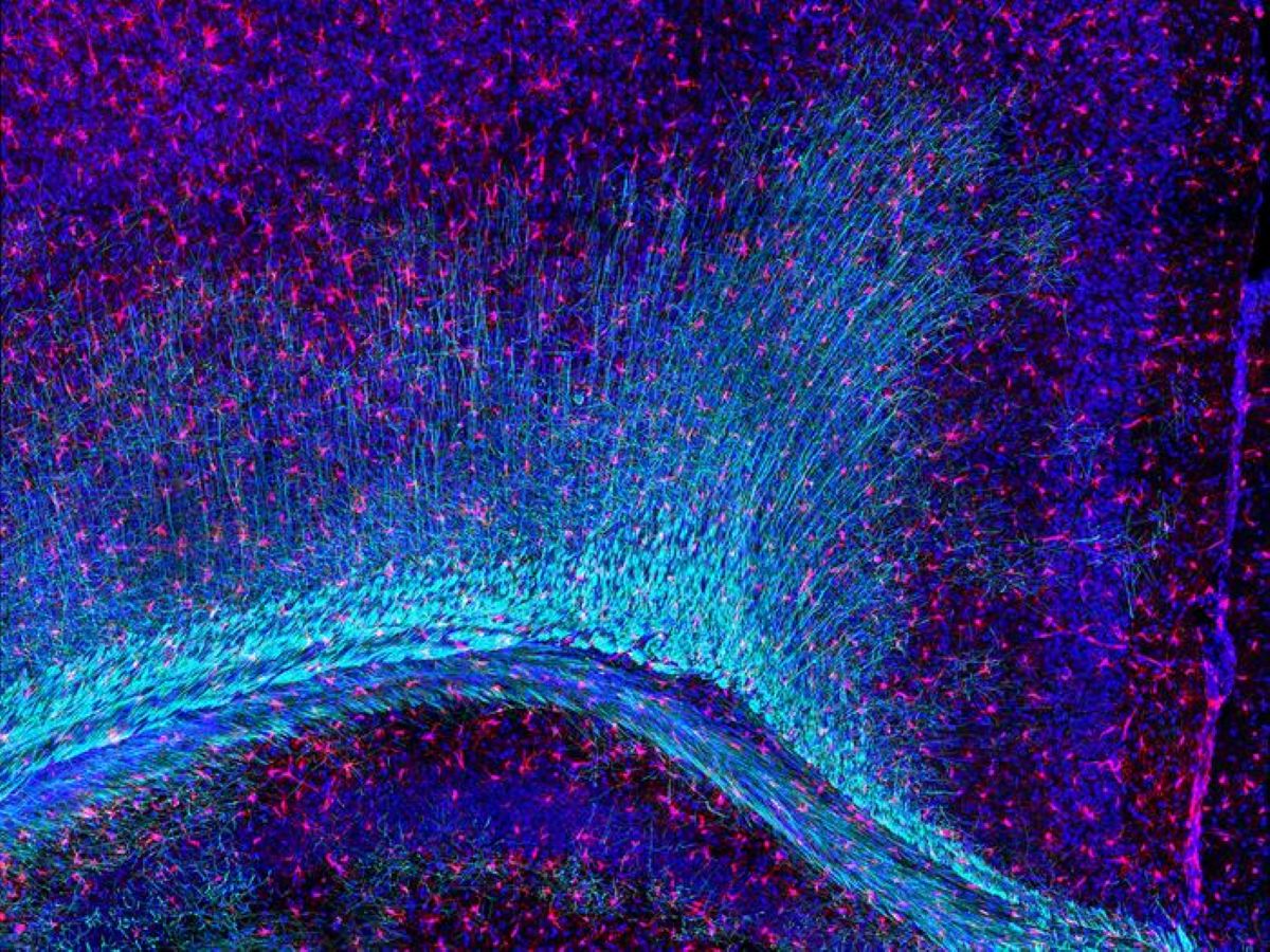 This shows myelin and microglia.
