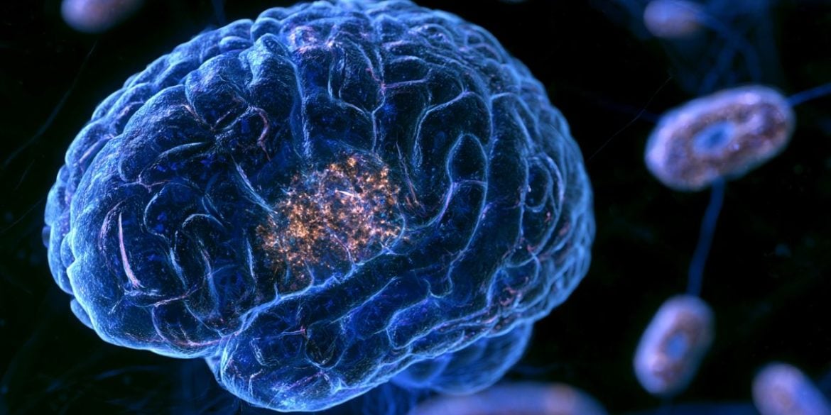 This shows a brain surrounded by mitochondria.