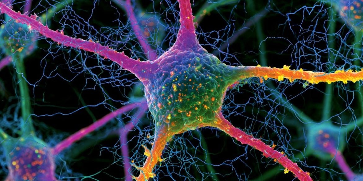 This shows a neuron.