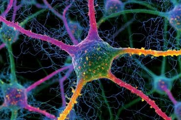 This shows a neuron.