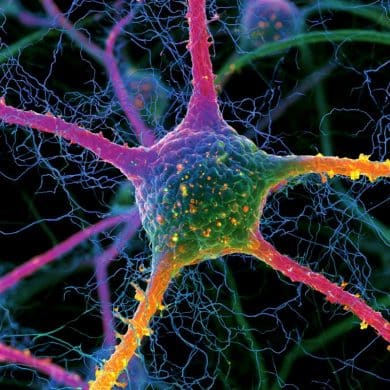 This shows a neuron.