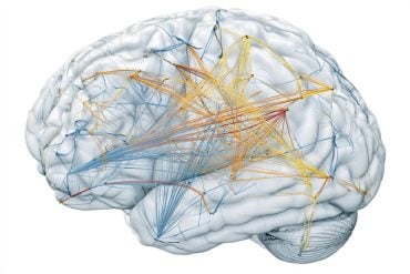 This shows a brain.