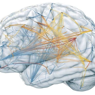 This shows a brain.