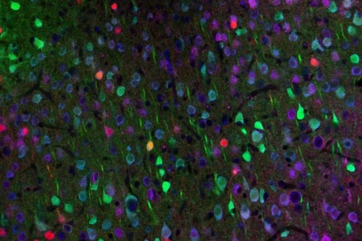 Optogenetics Restores Motor Learning in Huntingtons