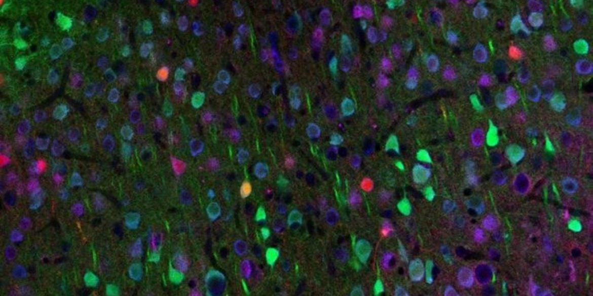This shows neurons.