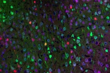 This shows neurons.