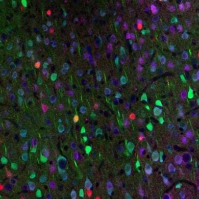 This shows neurons.