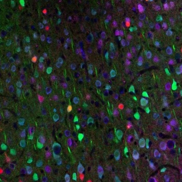 This shows neurons.