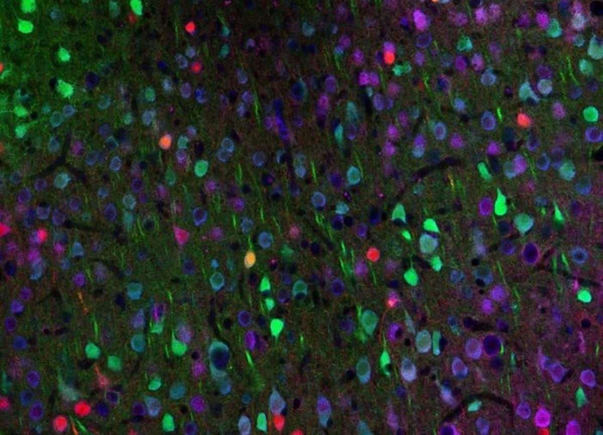 This shows neurons.