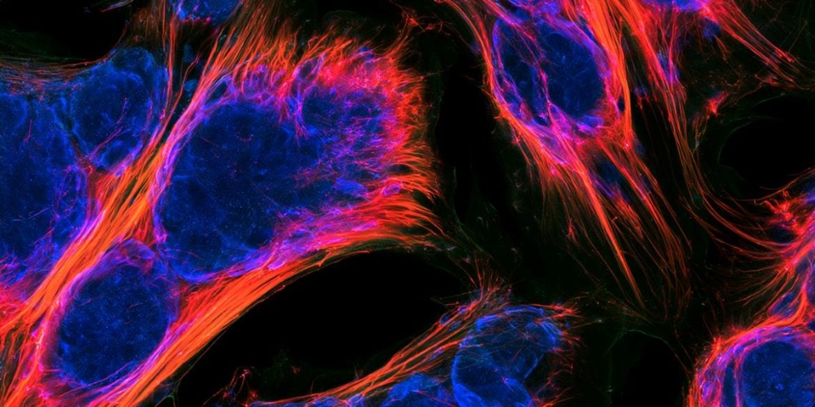 This shows stem cells.