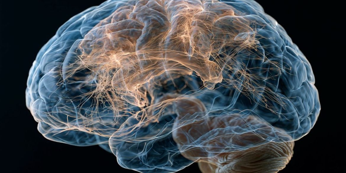 This shows a brain.
