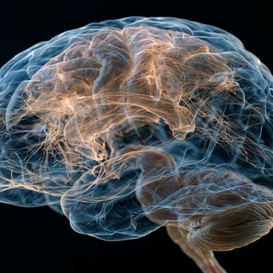 This shows a brain.