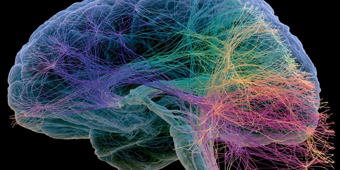 This shows a brain.