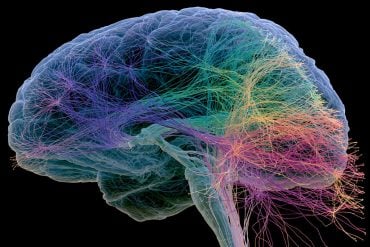 This shows a brain.