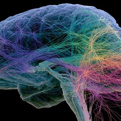 This shows a brain.