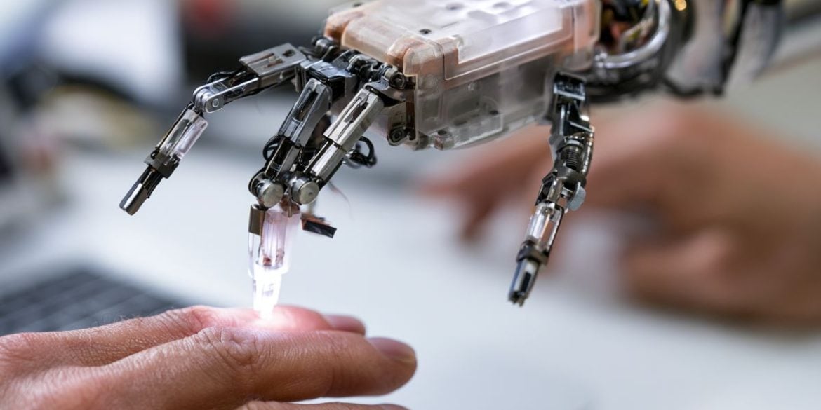 This shows a robotic hand.