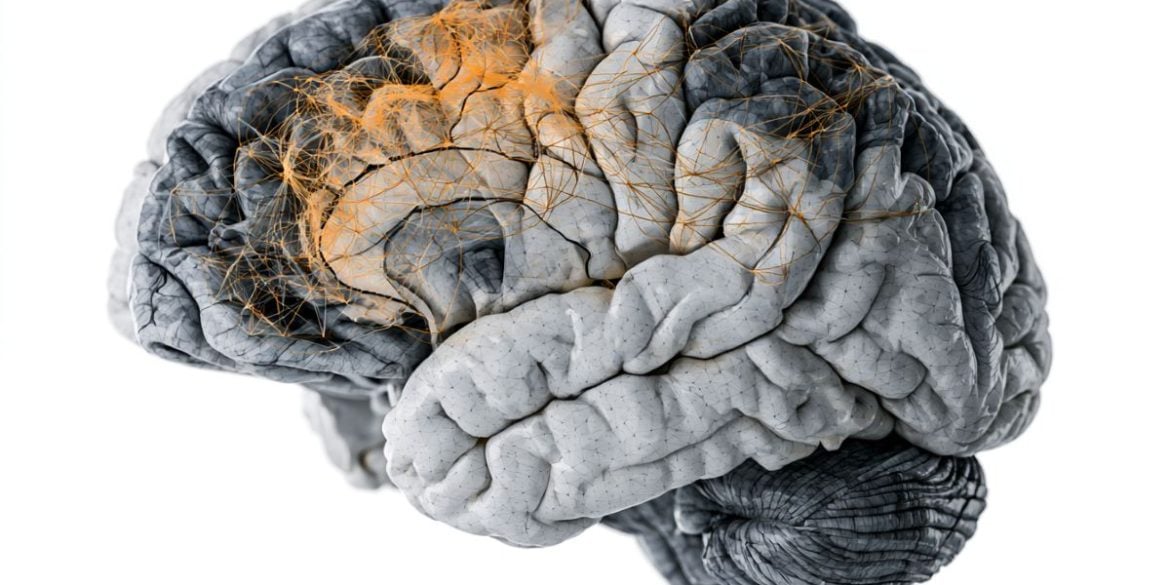 This shows a brain.