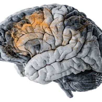 This shows a brain.