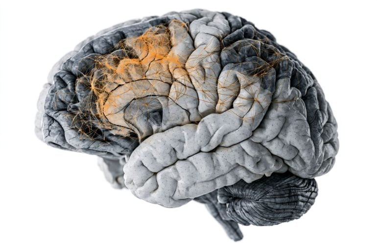 This shows a brain.