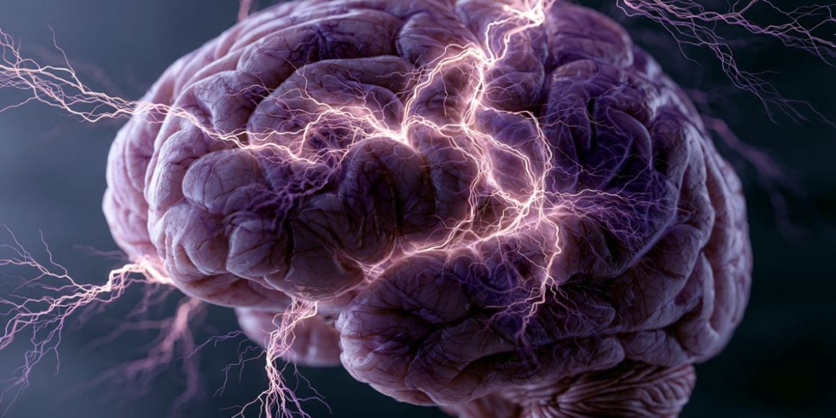 This shows a brain.