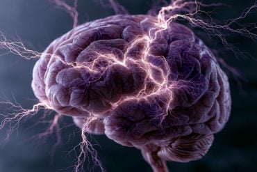 This shows a brain.