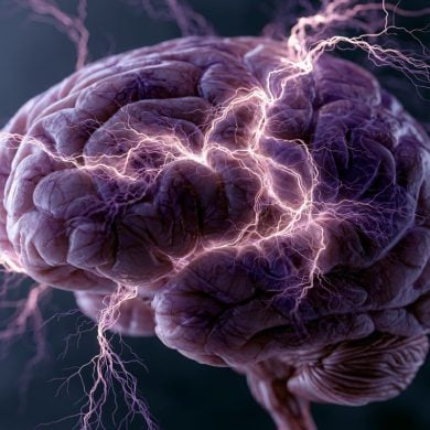 This shows a brain.