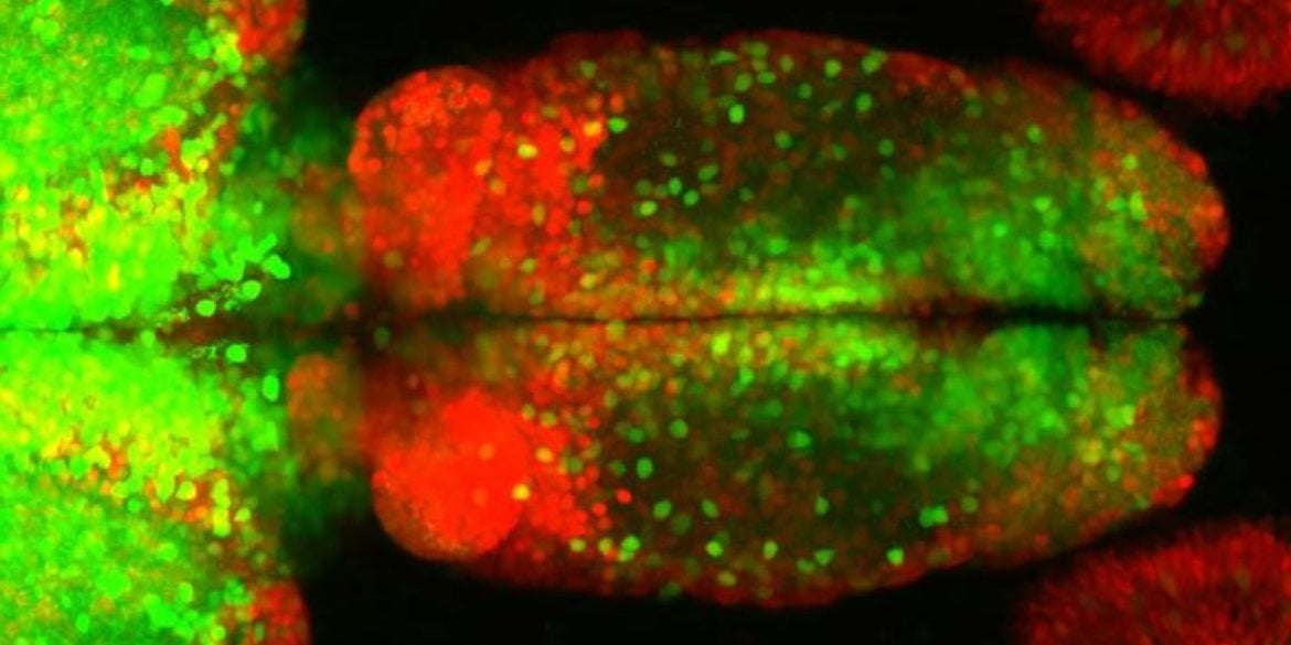 This shows neurons in the forebrain.