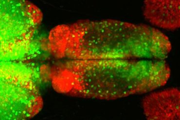 This shows neurons in the forebrain.