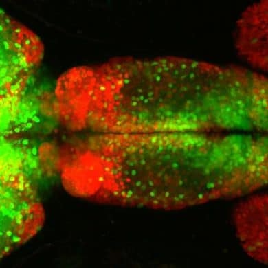 This shows neurons in the forebrain.