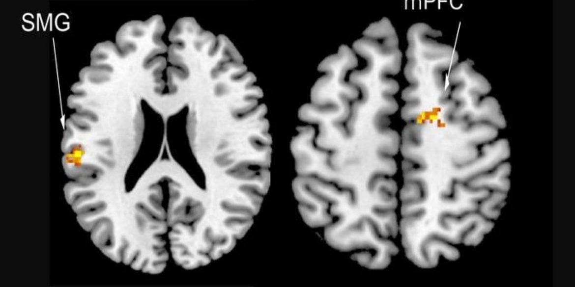 This shows brain scans of the areas activated in social rivalry.