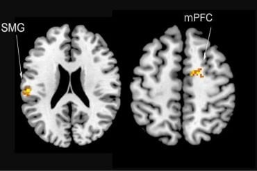 This shows brain scans of the areas activated in social rivalry.