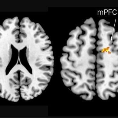 This shows brain scans of the areas activated in social rivalry.