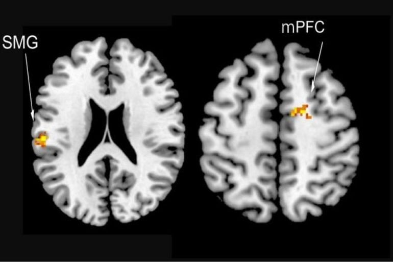 This shows brain scans of the areas activated in social rivalry.