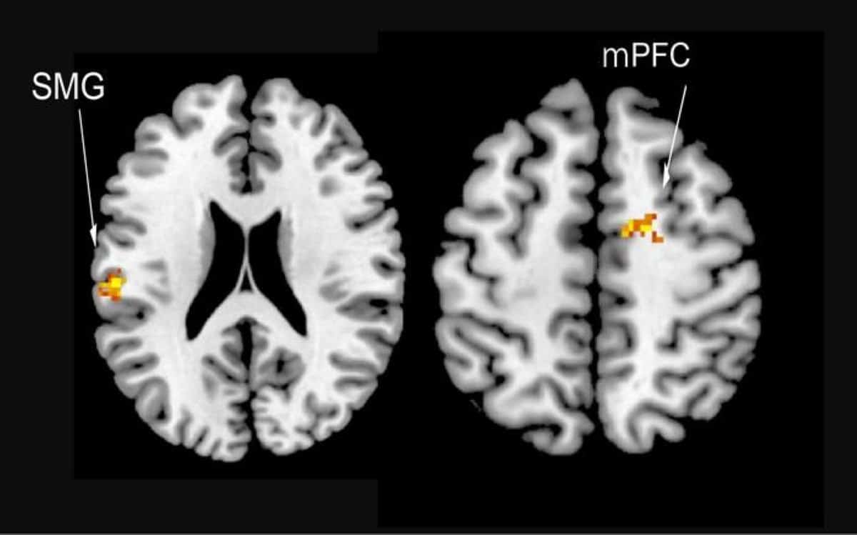 The Brain Prioritizes Spite Over Friendship