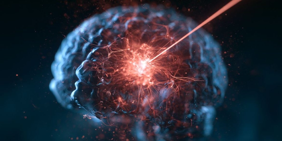 This shows a brain and a light beam.