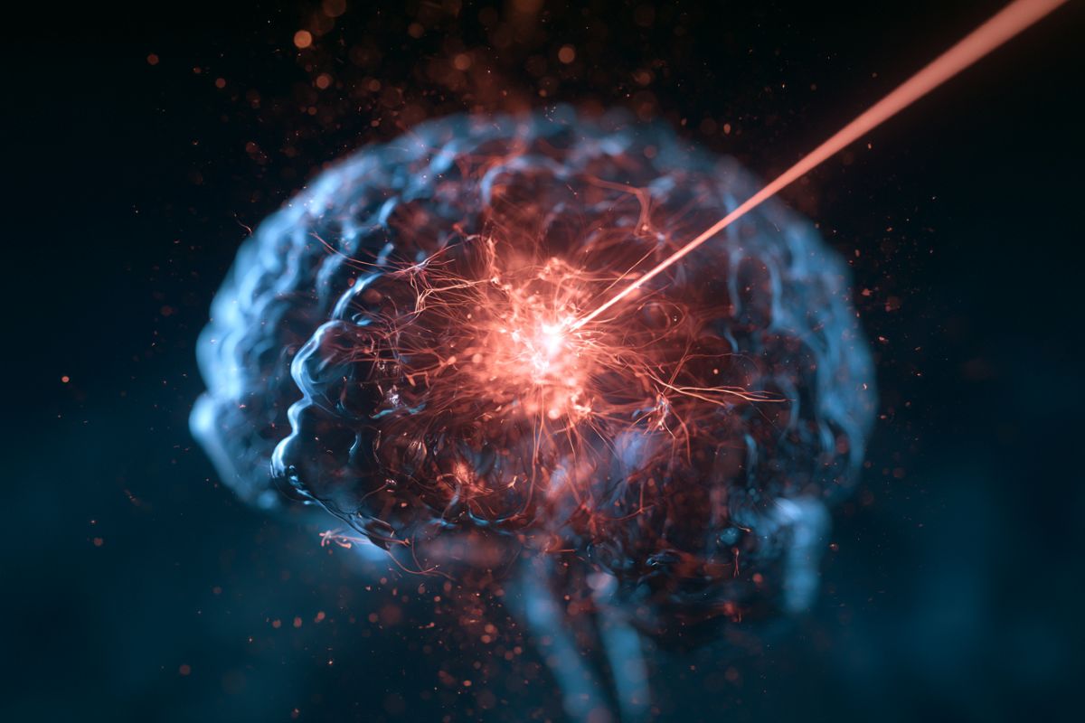 Focused Ultrasound Opens Blood-Brain Barrier to Treat Brain Cancer