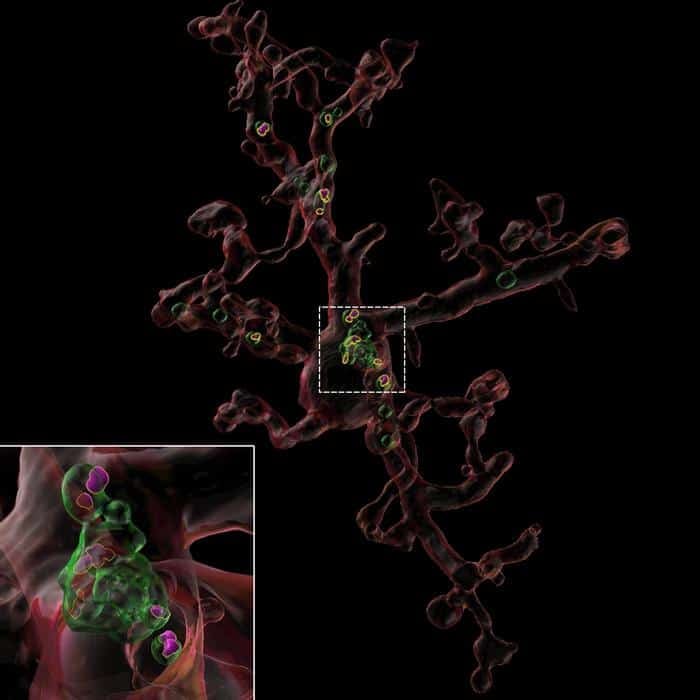 Image reconstruction of microglia from an aged mouse treated with TIMP2 showing synaptic material (purple) within the cell's lysosomes (green).