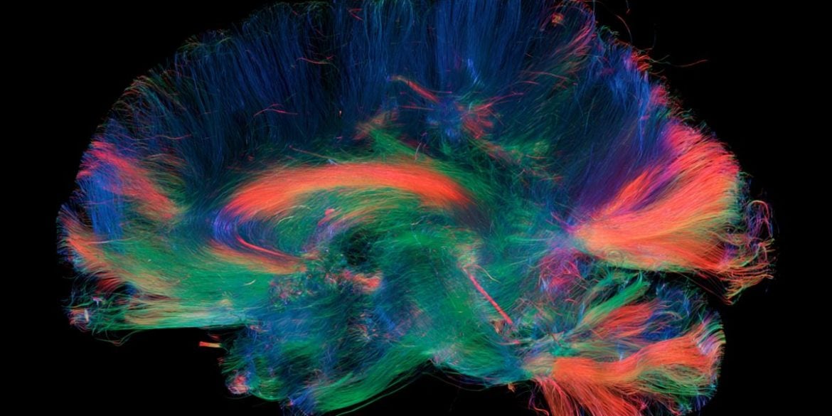 This shows a connectome.